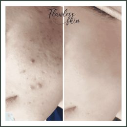 FLAWLESS SKIN - Fryzjer ślubny